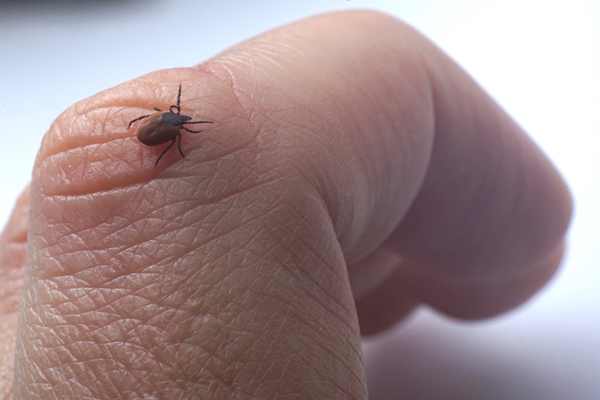 Female tick ( Ixodes scapularis) crawling on skin ready to bite